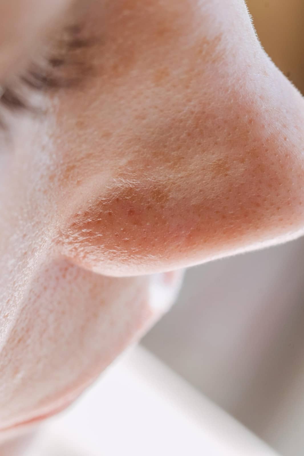 Struggling with Large Pores? Here's How To Minimise Their Appearance